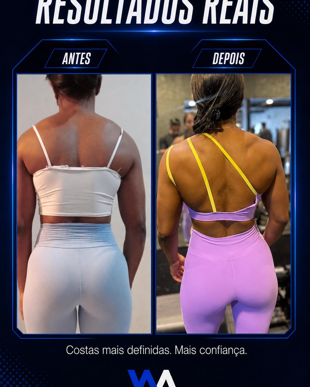 Comparativo antes e depois de aluna, costas mais definidas